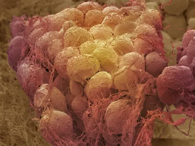 Fat tissue, as seen here under a scanning electron micrograph, maintains a &quot;memory&quot; of obesity, new research suggests.