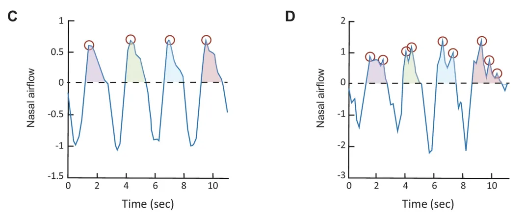 graph showing four inhalation peaks with four breaths in an anosmic participant, and nine inhalation peaks with four breaths in a participant who could smell